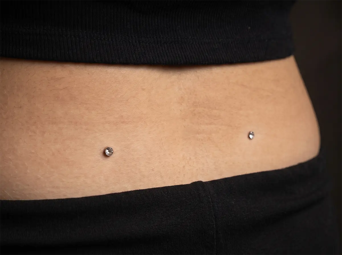 Bel ve kalça bölgesi dermal piercing