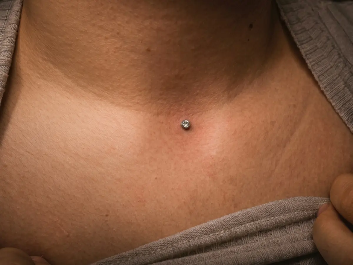 Microdermal ve Dermal Anchor